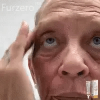Botox Bee Venom