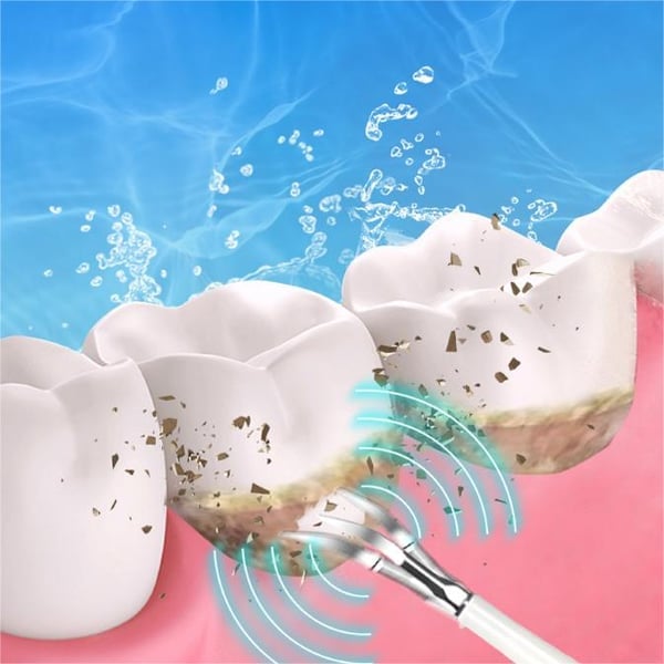Electric Teeth Cleaner TK
