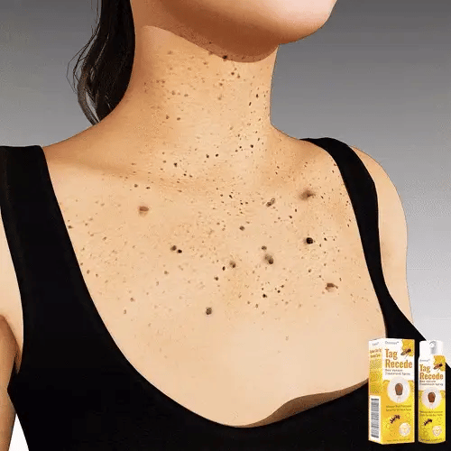 TagRecede Bee Venom Treatment Spray,