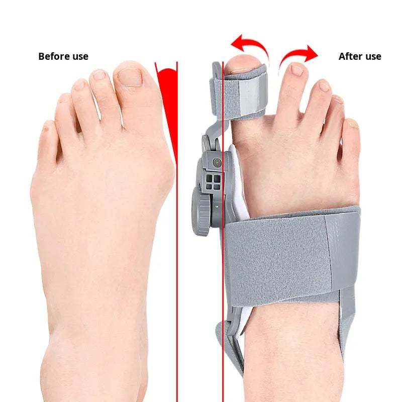 Bunion Corrector – Adjustable Big Toe Straightener TK