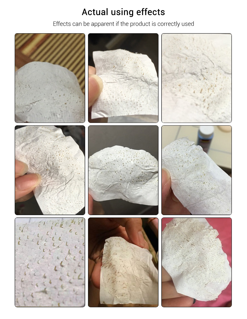 LANBENA Nose Blackhead Remover Mask