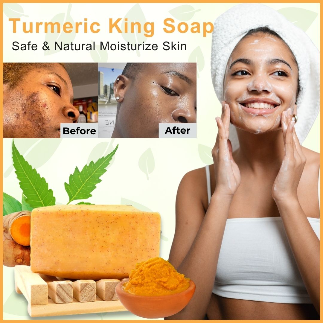 Organic Turmeric Soap for Radiant Skin